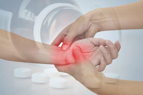 “Methotrexate”, “Leflunomide”. Basic drugs widely used in the treatment of juvenile idiopathic arthritis
 – 2024-02-29 14:44:17