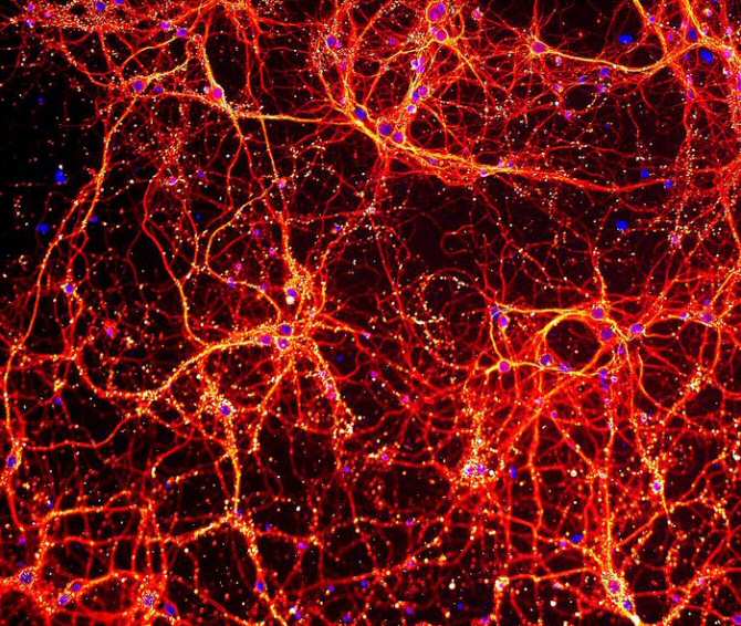 The striking resemblance between the large-scale universe and the inside of the brain