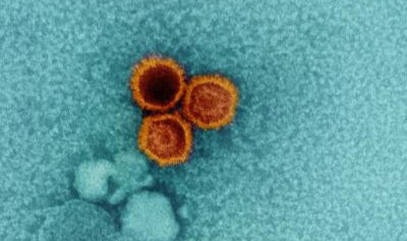 Severe COVID-19 Can Reactivate Up to 11 Dormant Viruses, Study Finds